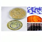 Pathology Kindle Book by Dr Subha Parameswaran-0